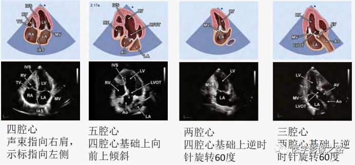 什么叫超声容积探头医学超声影像学笔记——心脏正常的解剖和超声评价_https://www.jmylbn.com_新闻资讯_第8张