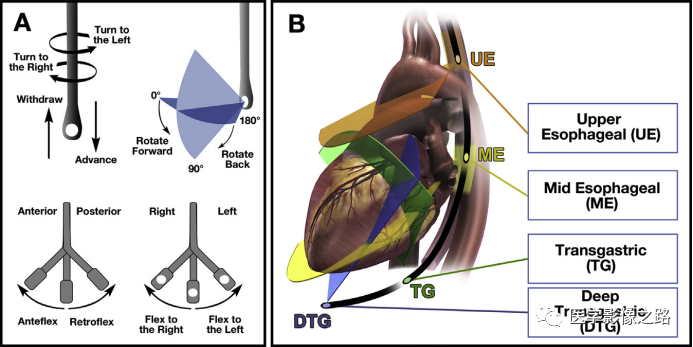 什么叫超声容积探头医学超声影像学笔记——心脏正常的解剖和超声评价_https://www.jmylbn.com_新闻资讯_第19张