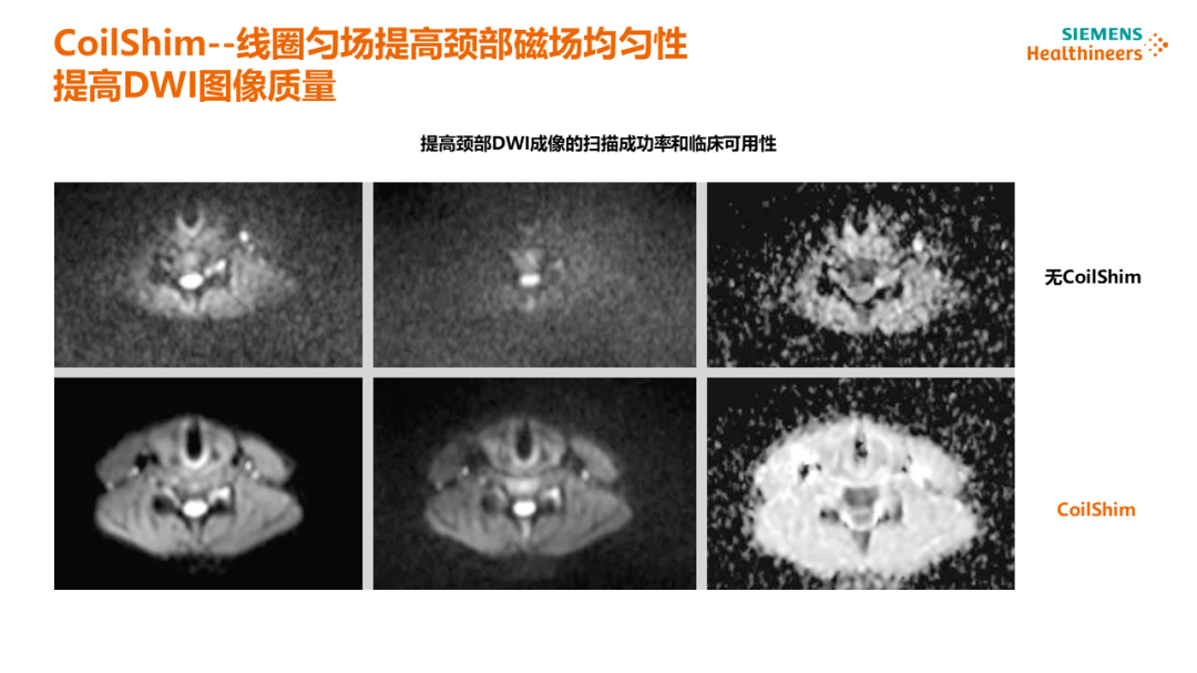 磁共振矩阵怎么计算【重磅】新一代智慧型生命感知磁共振——MAGNETOM Vida， 成功落户中大放射并全面投入使用！！！_https://www.jmylbn.com_新闻资讯_第45张