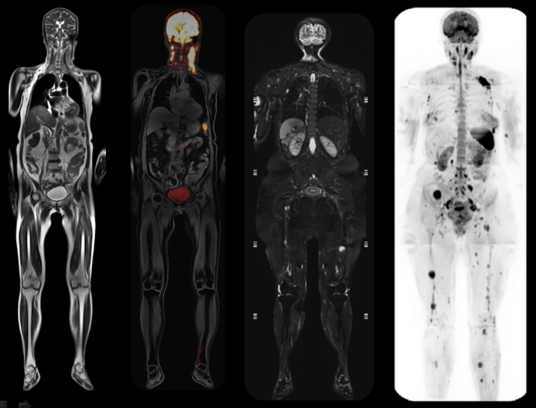 磁共振矩阵怎么计算【重磅】新一代智慧型生命感知磁共振——MAGNETOM Vida， 成功落户中大放射并全面投入使用！！！_https://www.jmylbn.com_新闻资讯_第17张
