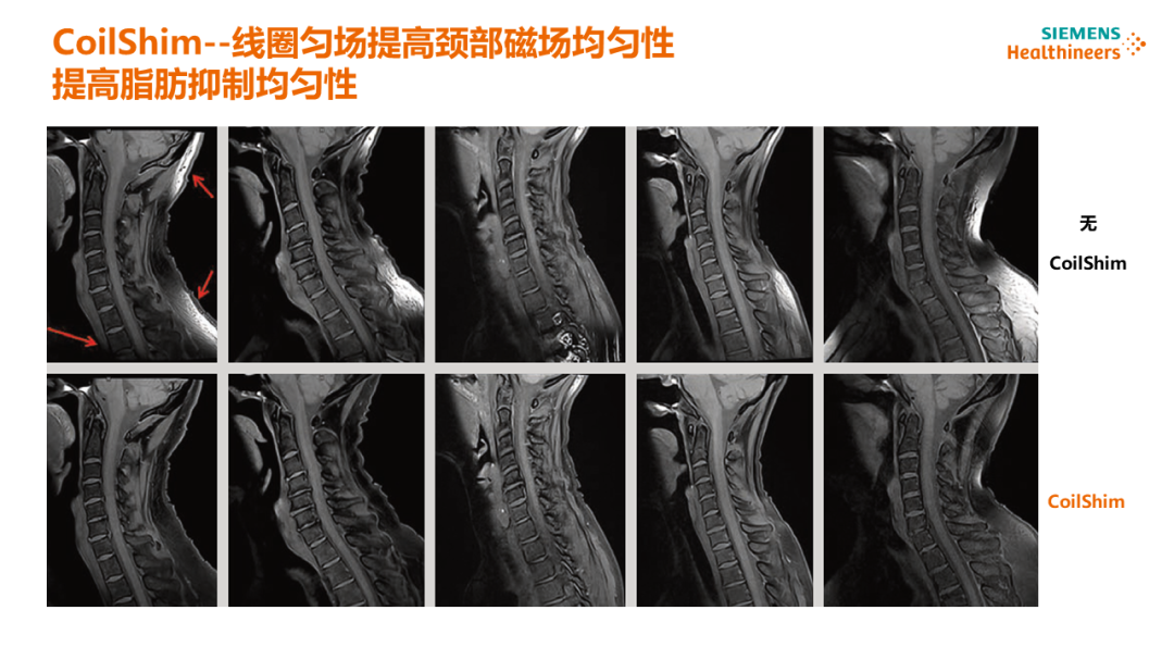 磁共振矩阵怎么计算【重磅】新一代智慧型生命感知磁共振——MAGNETOM Vida， 成功落户中大放射并全面投入使用！！！_https://www.jmylbn.com_新闻资讯_第44张