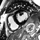 磁共振矩阵怎么计算【重磅】新一代智慧型生命感知磁共振——MAGNETOM Vida， 成功落户中大放射并全面投入使用！！！_https://www.jmylbn.com_新闻资讯_第40张