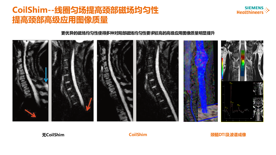 磁共振矩阵怎么计算【重磅】新一代智慧型生命感知磁共振——MAGNETOM Vida， 成功落户中大放射并全面投入使用！！！_https://www.jmylbn.com_新闻资讯_第46张