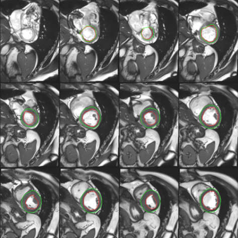 磁共振矩阵怎么计算【重磅】新一代智慧型生命感知磁共振——MAGNETOM Vida， 成功落户中大放射并全面投入使用！！！_https://www.jmylbn.com_新闻资讯_第39张