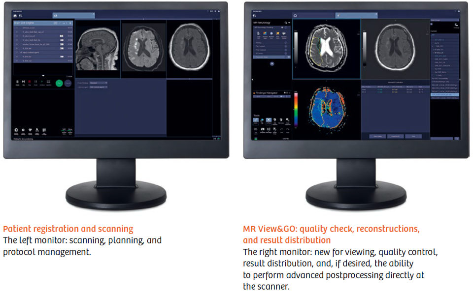 磁共振矩阵怎么计算【重磅】新一代智慧型生命感知磁共振——MAGNETOM Vida， 成功落户中大放射并全面投入使用！！！_https://www.jmylbn.com_新闻资讯_第16张