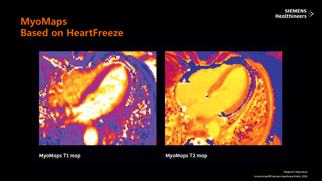 磁共振矩阵怎么计算【重磅】新一代智慧型生命感知磁共振——MAGNETOM Vida， 成功落户中大放射并全面投入使用！！！_https://www.jmylbn.com_新闻资讯_第36张