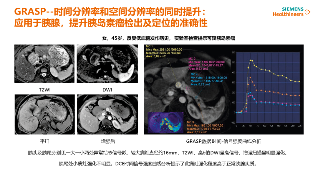 磁共振矩阵怎么计算【重磅】新一代智慧型生命感知磁共振——MAGNETOM Vida， 成功落户中大放射并全面投入使用！！！_https://www.jmylbn.com_新闻资讯_第29张