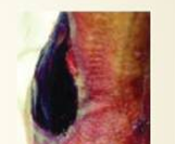 性敷料是什么压力性损伤（压疮）不同分期的敷料选择_https://www.jmylbn.com_新闻资讯_第8张