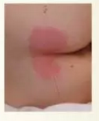 性敷料是什么压力性损伤（压疮）不同分期的敷料选择_https://www.jmylbn.com_新闻资讯_第2张