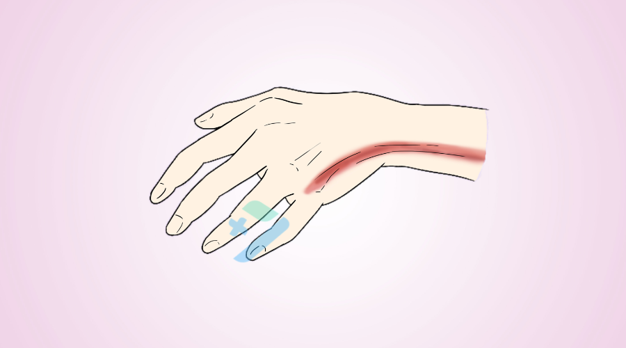 为什么微量泵会响微泵给药的这5大常见问题，千万别大意！_https://www.jmylbn.com_新闻资讯_第6张