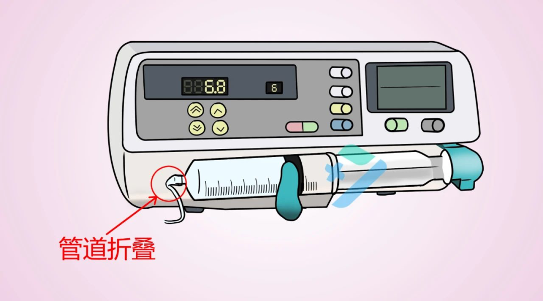 为什么微量泵会响微泵给药的这5大常见问题，千万别大意！_https://www.jmylbn.com_新闻资讯_第3张