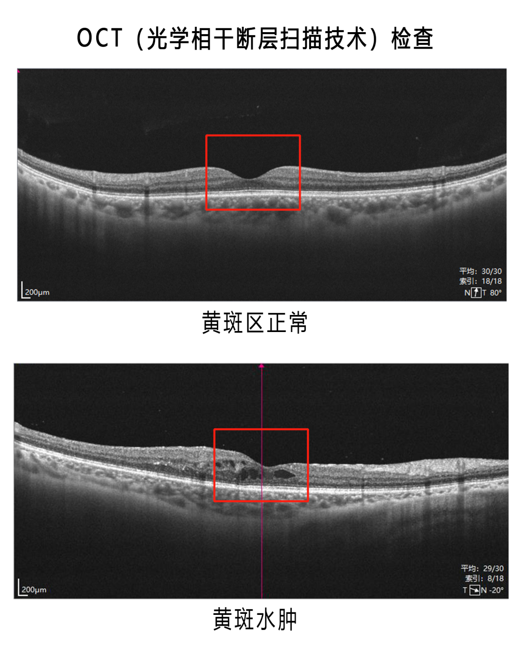 彩色眼底照相查什么眼底一张照，眼病早知道！哪些人的眼睛需要拍照？_https://www.jmylbn.com_新闻资讯_第3张