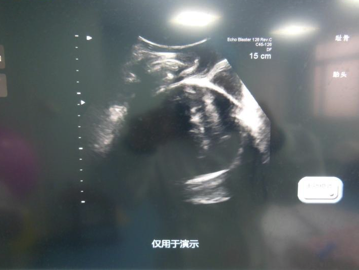 产程三维导航是什么准妈妈必看！什么是“产程三维导航”？_https://www.jmylbn.com_新闻资讯_第8张