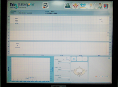 产程三维导航是什么准妈妈必看！什么是“产程三维导航”？_https://www.jmylbn.com_新闻资讯_第5张