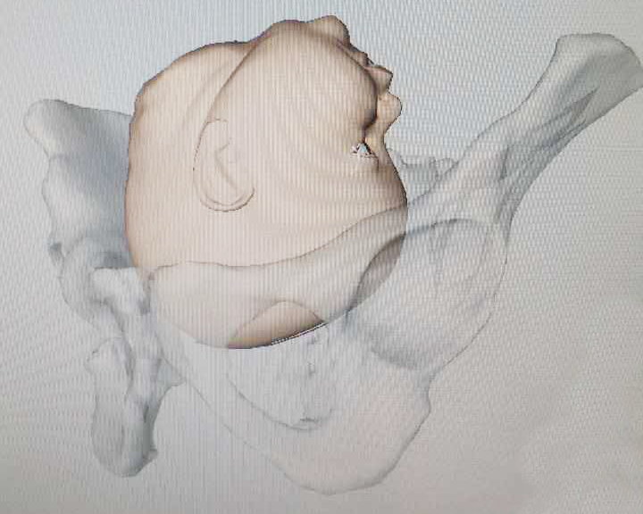 产程三维导航是什么准妈妈必看！什么是“产程三维导航”？_https://www.jmylbn.com_新闻资讯_第6张