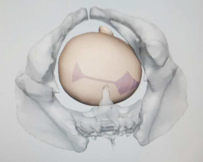 产程三维导航是什么准妈妈必看！什么是“产程三维导航”？_https://www.jmylbn.com_新闻资讯_第7张