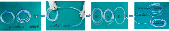 手术吸引器怎么使用手术室护士自制腹腔镜手术烟雾排除装置，烟雾退退退~_https://www.jmylbn.com_新闻资讯_第2张