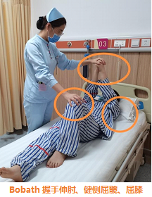 医用病床怎么移动图解超全图解分享！偏瘫患者床椅转移方法，安全有效节力转移偏瘫患者_https://www.jmylbn.com_新闻资讯_第4张