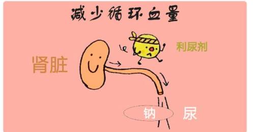 代表药物:氢氯噻嗪片,速尿,吲达帕胺等