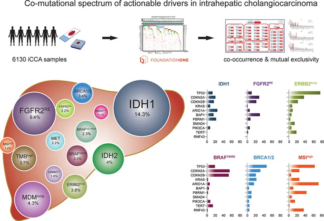胆管癌-可愈有道