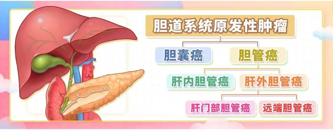 胆管癌-可愈有道