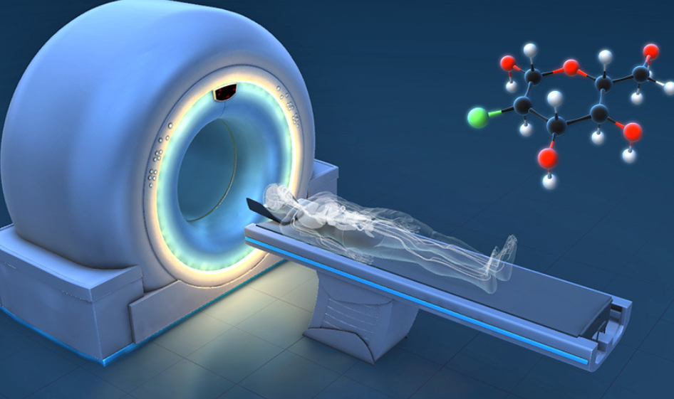 如何通过影像检查提前发现-可愈有道