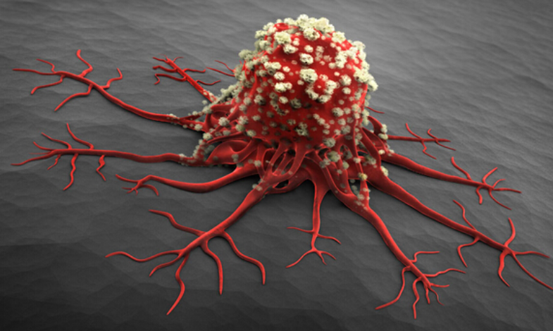 如何通过影像检查提前发现-可愈有道