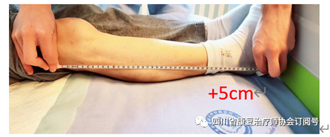 手动轮椅什么牌子好偏瘫患者的轮椅选配_https://www.jmylbn.com_新闻资讯_第1张