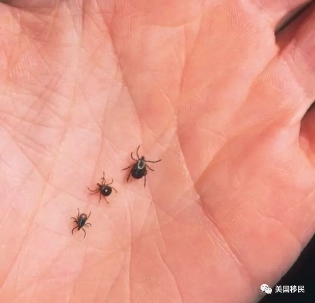 近期在美看到这种虫子小心 女孩被咬一口直接瘫痪