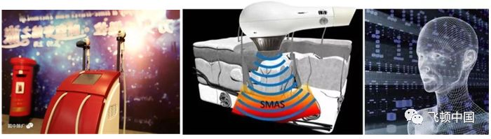 多极射频是什么【科普】射频RF应用于医美抗衰发展历程_https://www.jmylbn.com_新闻资讯_第13张