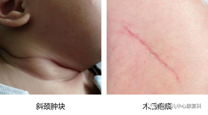 中频为什么能镇痛【康复小知识】中频电疗法_https://www.jmylbn.com_新闻资讯_第1张