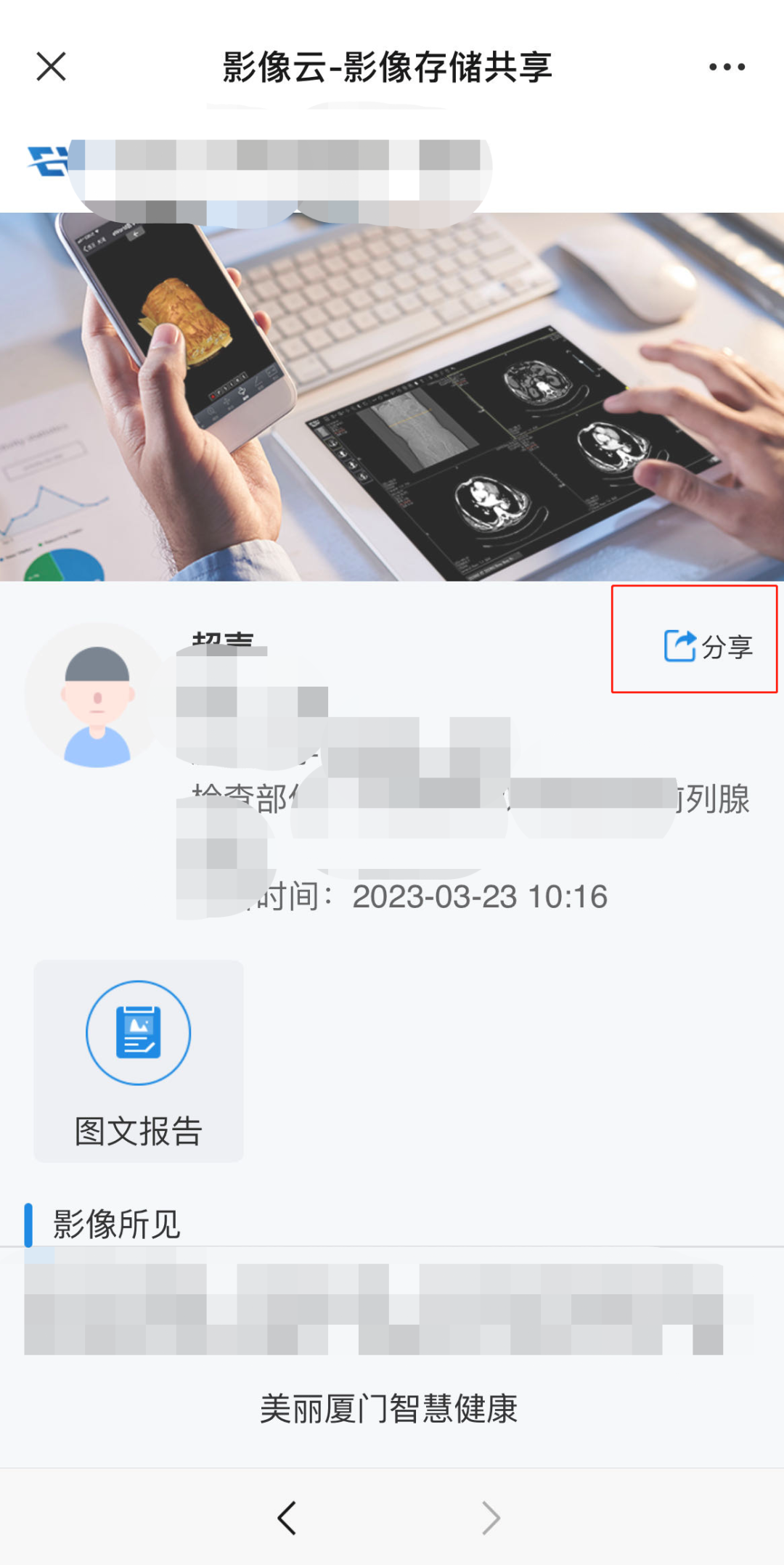 为什么x光片用胶片X光片“存”手机里带走，医疗影像云胶片来了！_https://www.jmylbn.com_新闻资讯_第10张