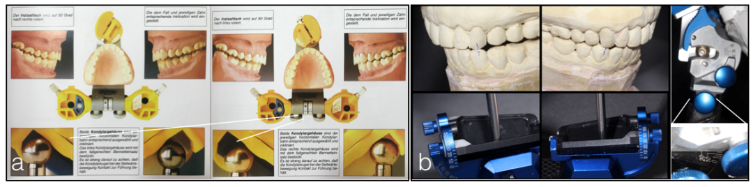 半可调颌架有哪些HE架模拟下颌运动的原理及常见分类_https://www.jmylbn.com_新闻资讯_第11张