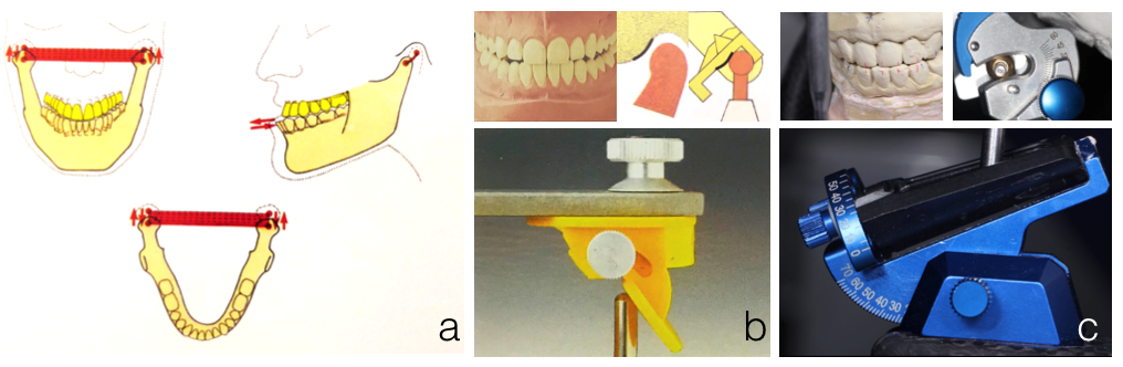 半可调颌架有哪些HE架模拟下颌运动的原理及常见分类_https://www.jmylbn.com_新闻资讯_第10张