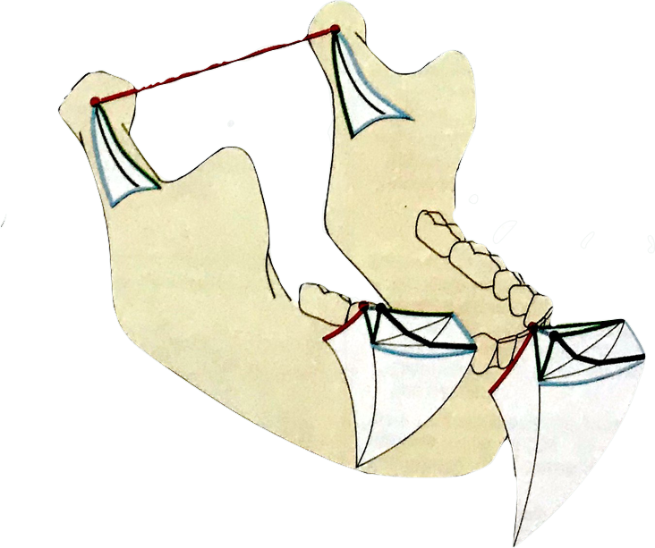 半可调颌架有哪些HE架模拟下颌运动的原理及常见分类_https://www.jmylbn.com_新闻资讯_第7张