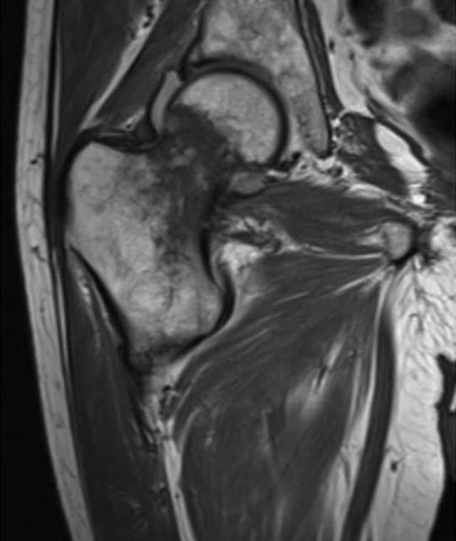 怎么取放射片研究--浅析下肢创伤中容易漏诊的X线片_https://www.jmylbn.com_新闻资讯_第8张