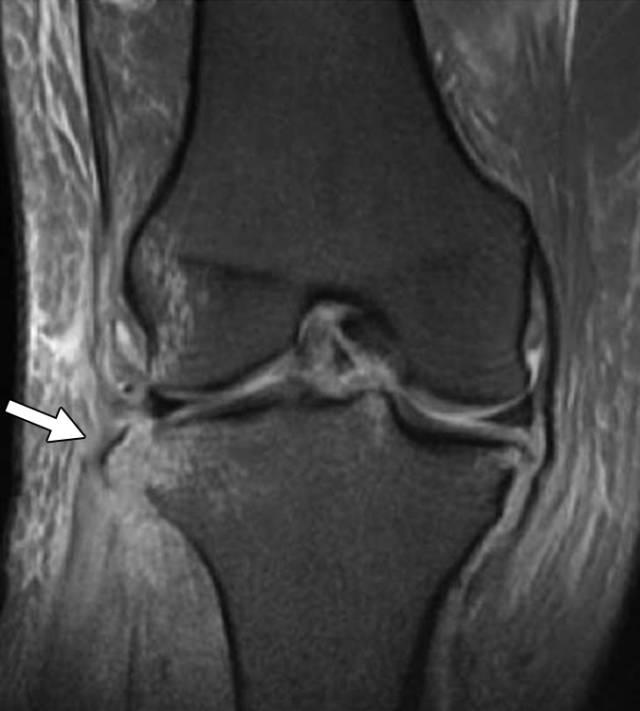 怎么取放射片研究--浅析下肢创伤中容易漏诊的X线片_https://www.jmylbn.com_新闻资讯_第20张