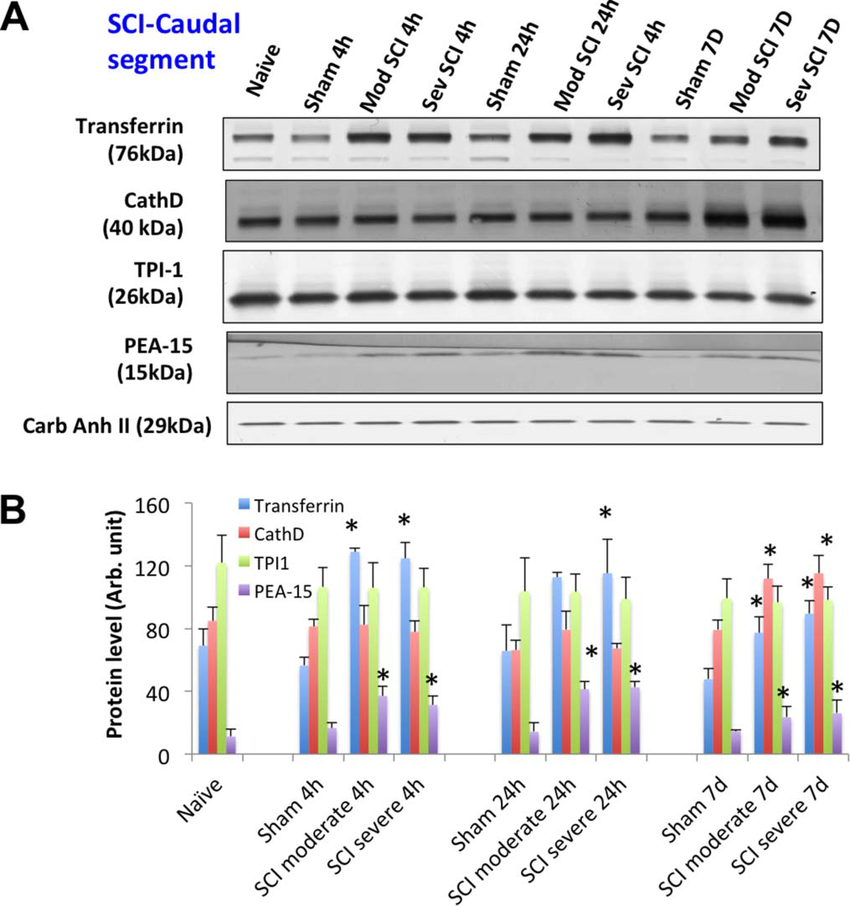 什么是特定蛋白实验中最常说的“跑个条带看看”是什么意思——Western blot ｜ 科研技术速递_https://www.jmylbn.com_新闻资讯_第4张