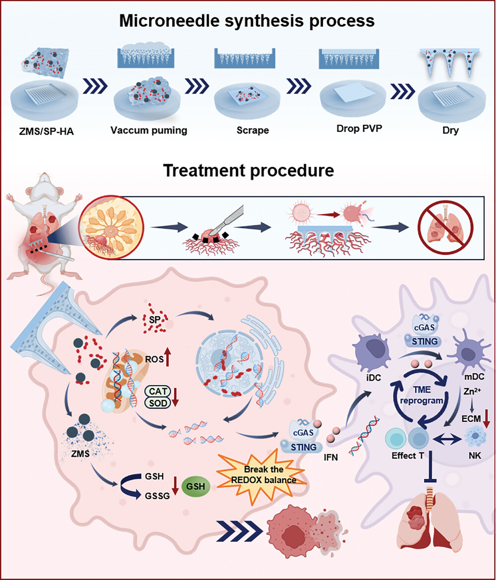 摩方3D打印翻模植入式微針激活免疫，預(yù)防術(shù)后三陰性乳腺癌復(fù)發(fā)與轉(zhuǎn)移