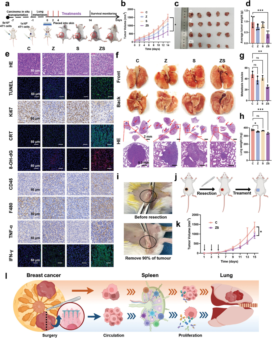 摩方3D打印翻模植入式微針激活免疫，預(yù)防術(shù)后三陰性乳腺癌復(fù)發(fā)與轉(zhuǎn)移