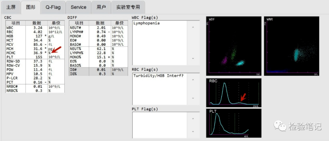 rbc直方图怎么看“实战演练”——用血常规散点图判断异常结果_https://www.jmylbn.com_新闻资讯_第15张