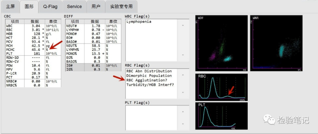 rbc直方图怎么看“实战演练”——用血常规散点图判断异常结果_https://www.jmylbn.com_新闻资讯_第14张