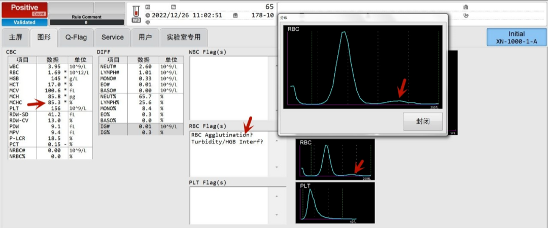 rbc直方图怎么看“实战演练”——用血常规散点图判断异常结果_https://www.jmylbn.com_新闻资讯_第18张