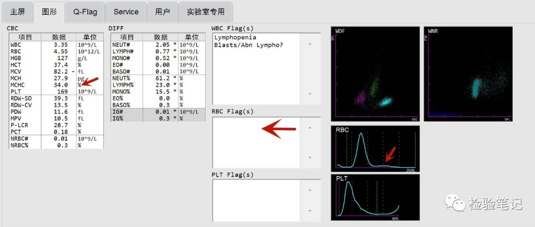 rbc直方图怎么看“实战演练”——用血常规散点图判断异常结果_https://www.jmylbn.com_新闻资讯_第16张