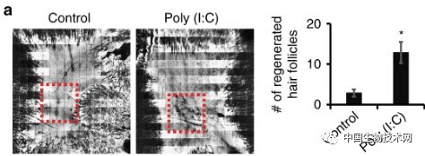 激光嫩肤、祛斑除皱...科学家阐明其背后的工作原理
