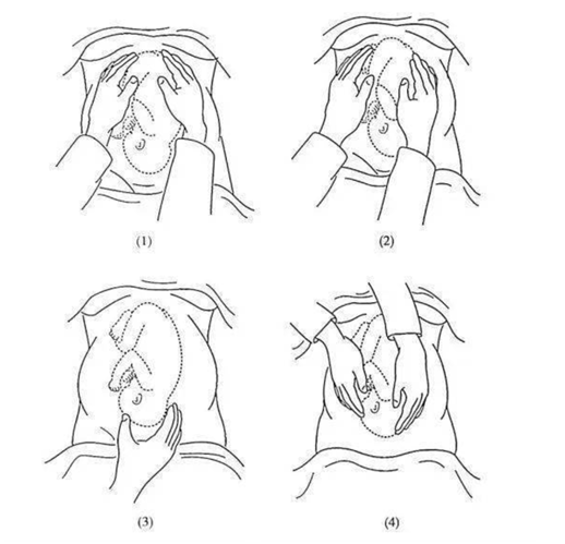 产科实操必修四步触诊法