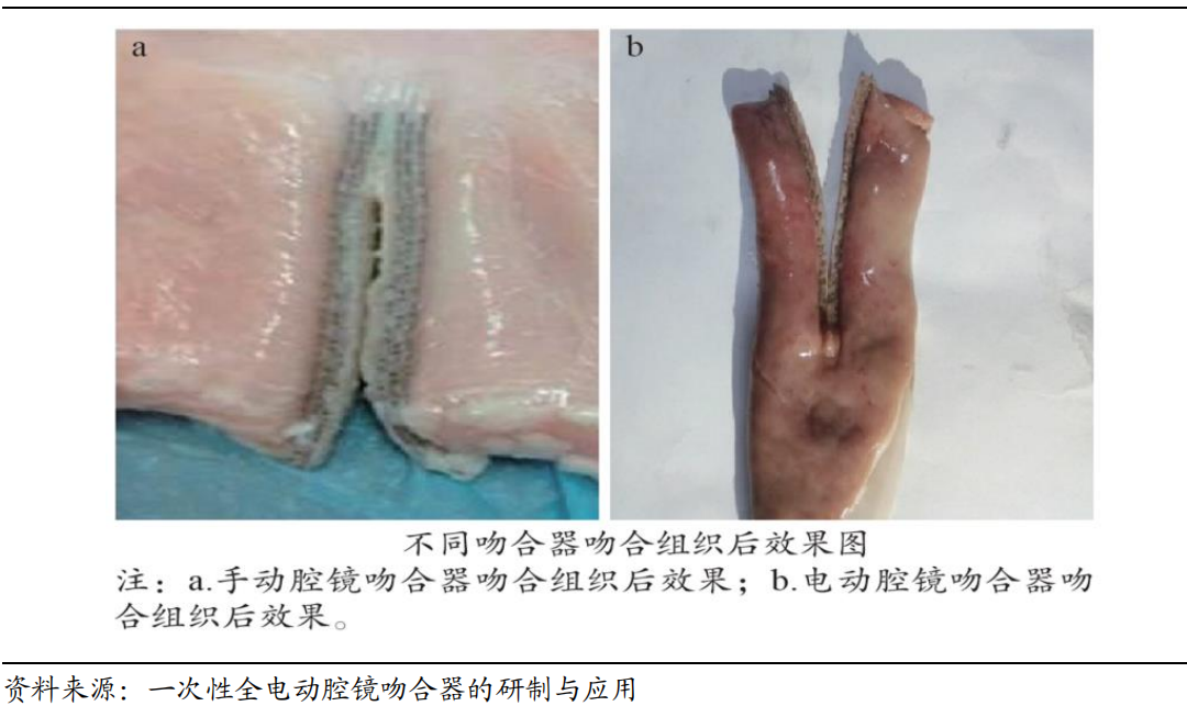 医用吻合器是什么市场规模将近200亿元！国产电动吻合器机会几何？_https://www.jmylbn.com_新闻资讯_第15张