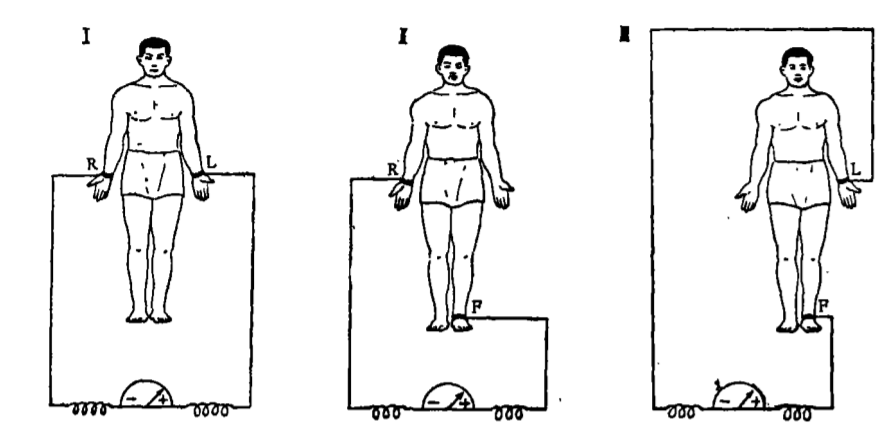 心电图怎么切换导联你了解过心电图导联吗？_https://www.jmylbn.com_新闻资讯_第5张