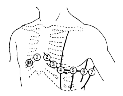 心电图怎么切换导联你了解过心电图导联吗？_https://www.jmylbn.com_新闻资讯_第8张
