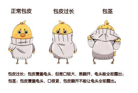 包皮自动切除环怎么用更快，更无痛，更微创的包皮环切术——包皮切割吻合器_https://www.jmylbn.com_新闻资讯_第3张